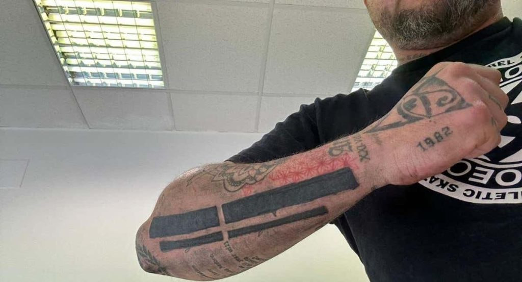 El ultra del Espanyol muestra el tatuaje borrado.