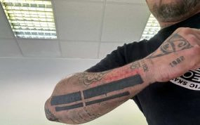 El ultra del Espanyol muestra el tatuaje borrado.