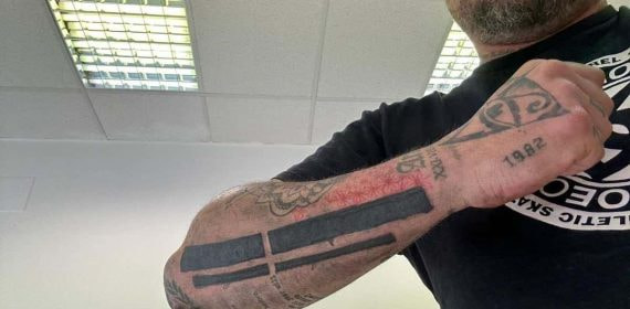 El ultra del Espanyol muestra el tatuaje borrado.