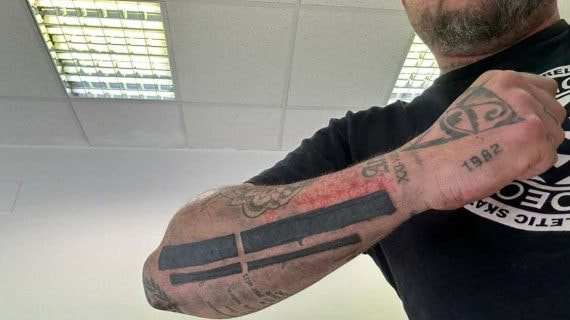 El ultra del Espanyol muestra el tatuaje borrado.
