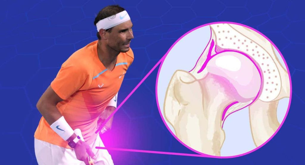 Nadal fue sometido el viernes a una operación para reparar el tejido del lábrum de su pierna izquierda.