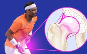 Nadal fue sometido el viernes a una operación para reparar el tejido del lábrum de su pierna izquierda.