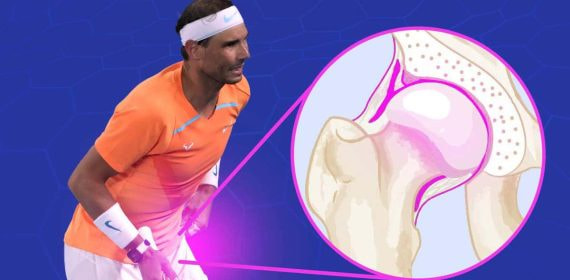 Nadal fue sometido el viernes a una operación para reparar el tejido del lábrum de su pierna izquierda.