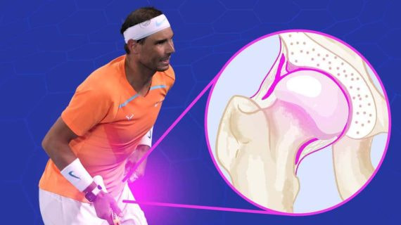 Nadal fue sometido el viernes a una operación para reparar el tejido del lábrum de su pierna izquierda.