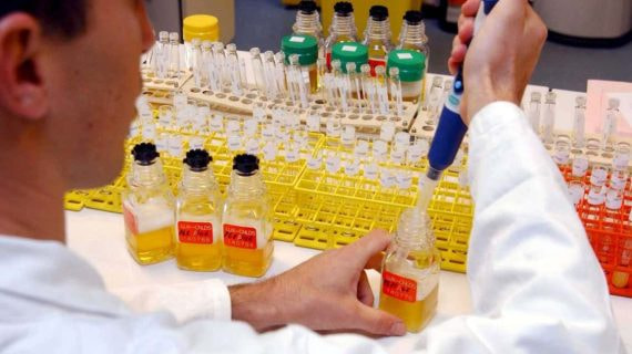 Fotografía de un laboratorio francés donde se analizan muestras antidopaje.