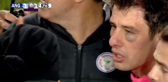 Halil Umut Meler, colegiado del partido, visiblemente agredido.