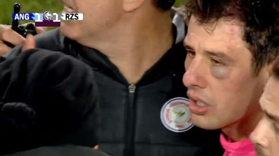 Halil Umut Meler, colegiado del partido, visiblemente agredido.