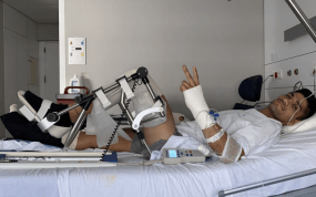 Jorge Martín tras ser operado de las siete fracturas.