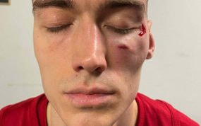 Así ha quedado Lazarevic tras ser agredido.