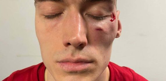 Así ha quedado Lazarevic tras ser agredido.
