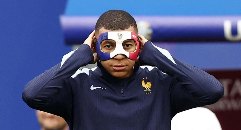Kylian Mbappé tendrá que utilizar una aparatosa máscara.