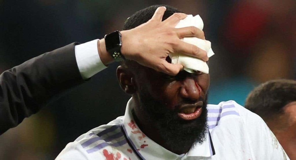 Rüdiger es atendido tras un golpe en la cabeza.