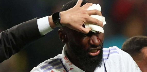 Rüdiger es atendido tras un golpe en la cabeza.