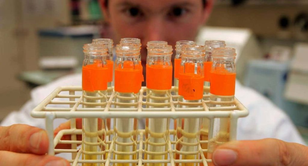 Imágenes de archivo del análisis de test antidopaje de un laboratorio en Laussane, Suiza.