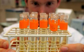 Imágenes de archivo del análisis de test antidopaje de un laboratorio en Laussane, Suiza.