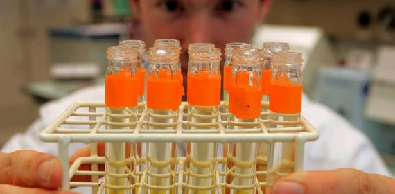 Imágenes de archivo del análisis de test antidopaje de un laboratorio en Laussane, Suiza.