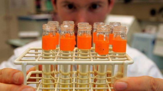 Imágenes de archivo del análisis de test antidopaje de un laboratorio en Laussane, Suiza.