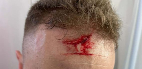 Imagen de la frente del árbitro agredido.