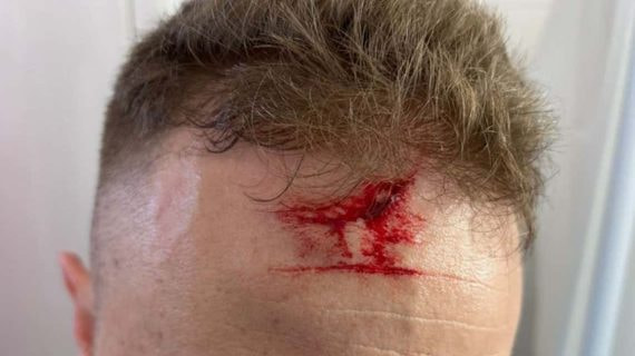 Imagen de la frente del árbitro agredido.