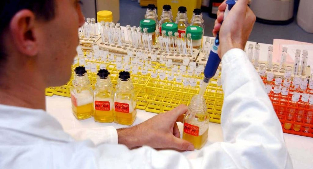 Imagen del análisis de muestras de controles antidopaje en el laboratorio.