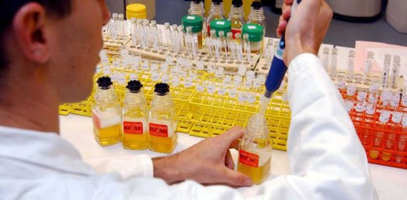 Imagen del análisis de muestras de controles antidopaje en el laboratorio.
