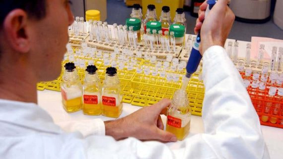 Imagen del análisis de muestras de controles antidopaje en el laboratorio.