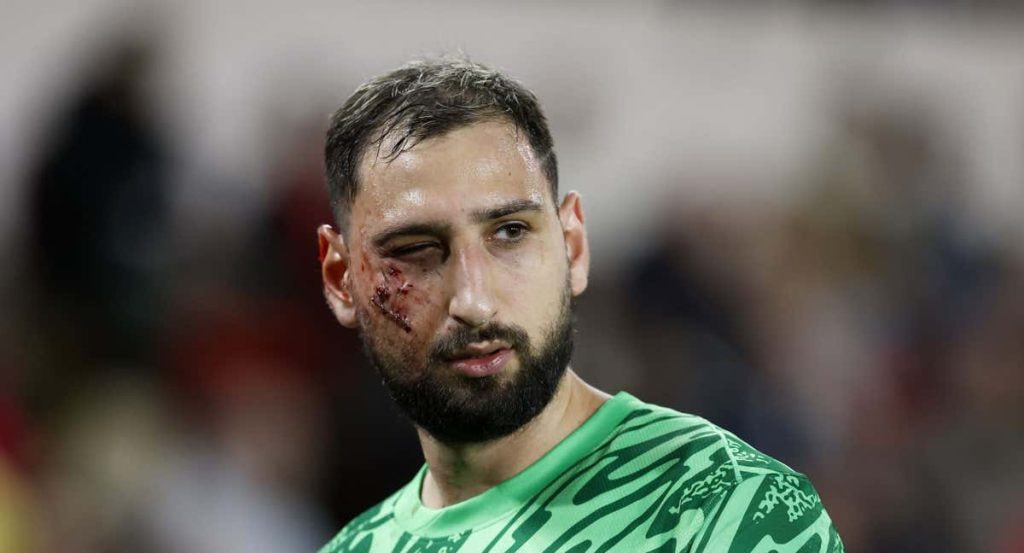 Donnarumma, con heridas en el partido ante el Mónaco.
