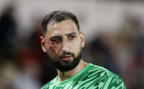 Donnarumma, con heridas en el partido ante el Mónaco.