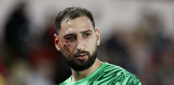 Donnarumma, con heridas en el partido ante el Mónaco.