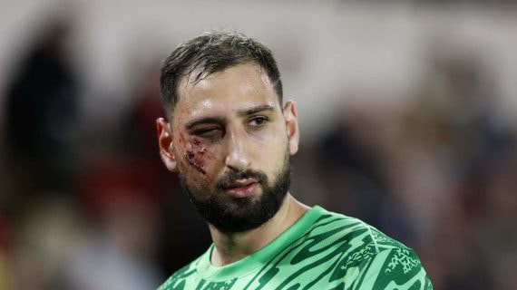 Donnarumma, con heridas en el partido ante el Mónaco.