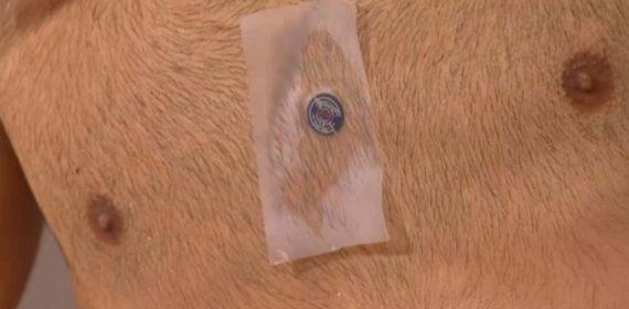 El curioso parche en el pecho de Djokovic durante su partido de Roland Garros.